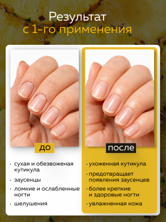 Масло укрепляющее двухфазное для ногтей Pineapple, Global Fashion, 60 мл